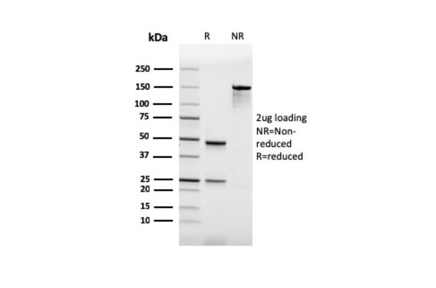 SDS-PAGE - Anti-PU.1 Antibody [rPU1/2146] (A277922) - Antibodies.com