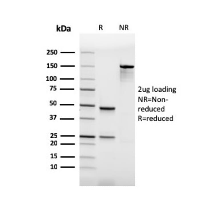 SDS-PAGE - Anti-PU.1 Antibody [rPU1/2146] (A277922) - Antibodies.com