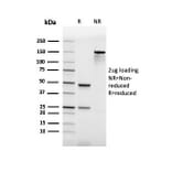 SDS-PAGE - Anti-PU.1 Antibody [rPU1/2146] (A277922) - Antibodies.com