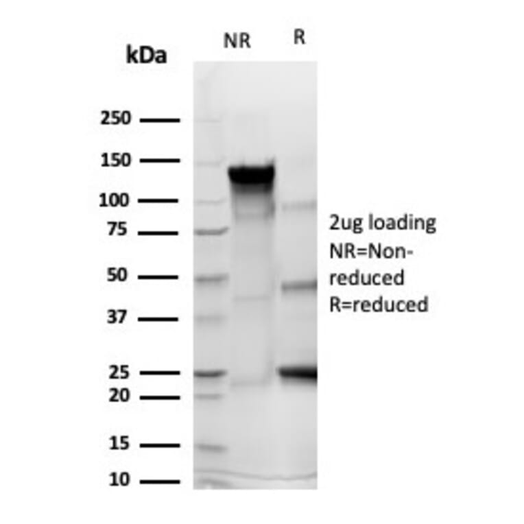 SDS-PAGE - Anti-CD43 Antibody [rSPN/6563] (A277923) - Antibodies.com