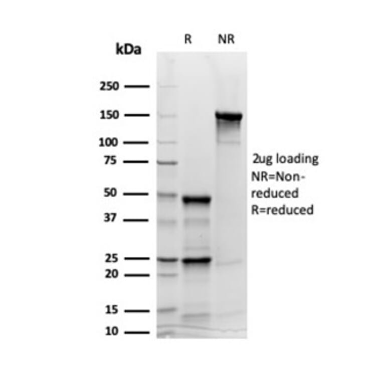 SDS-PAGE - Anti-Synaptophysin Antibody [rSYP/6856] (A277924) - Antibodies.com