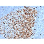 Immunohistochemistry - Anti-Topoisomerase II alpha Antibody [rTOP2A/6569] (A277925) - Antibodies.com