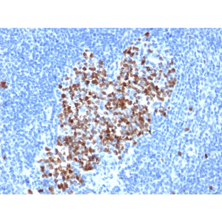 Immunohistochemistry - Anti-Topoisomerase II alpha Antibody [rTOP2A/6569] (A277925) - Antibodies.com