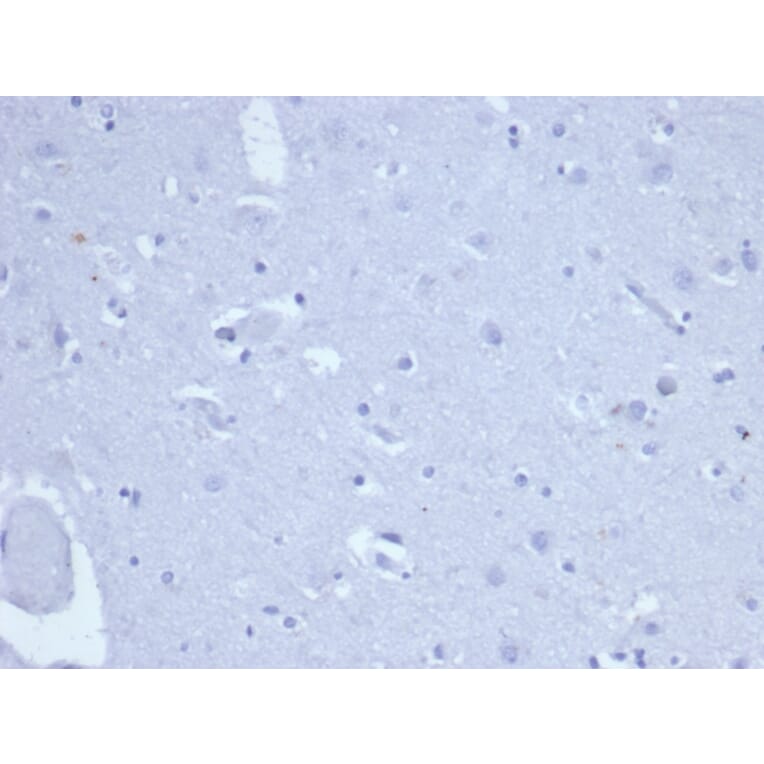 Immunohistochemistry - Anti-Topoisomerase II alpha Antibody [rTOP2A/6569] (A277925) - Antibodies.com