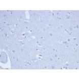 Immunohistochemistry - Anti-Topoisomerase II alpha Antibody [rTOP2A/6569] (A277925) - Antibodies.com