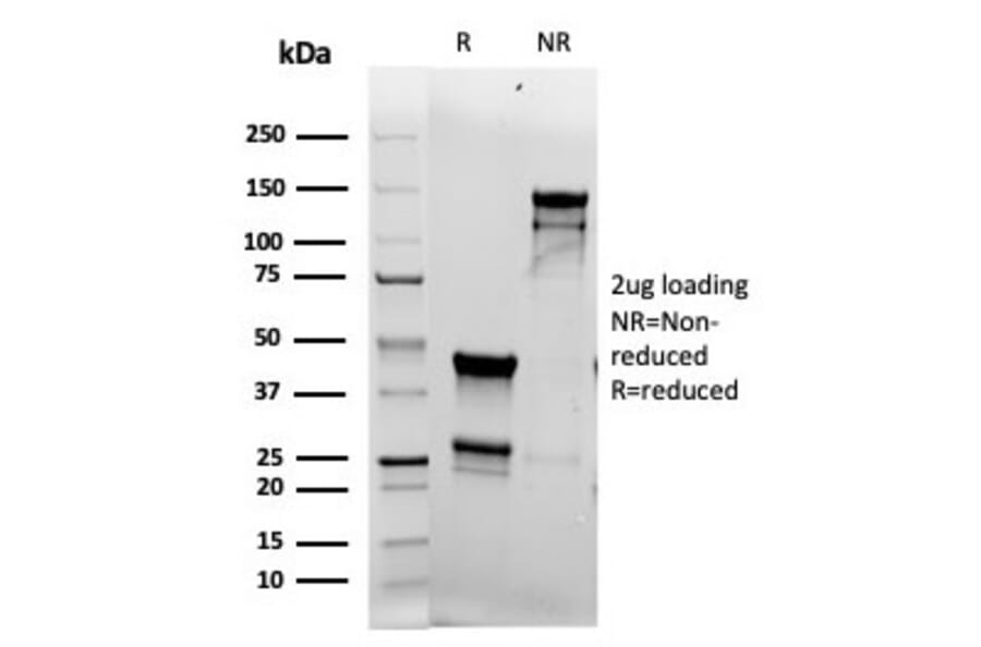 SDS-PAGE - Anti-Topoisomerase II alpha Antibody [rTOP2A/6569] (A277925) - Antibodies.com