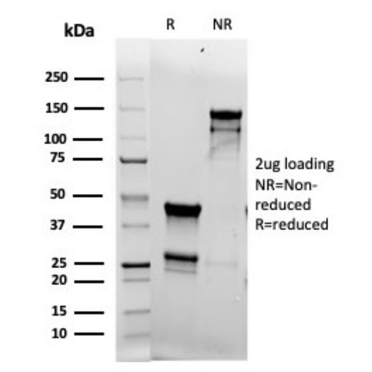 SDS-PAGE - Anti-Topoisomerase II alpha Antibody [rTOP2A/6569] (A277925) - Antibodies.com