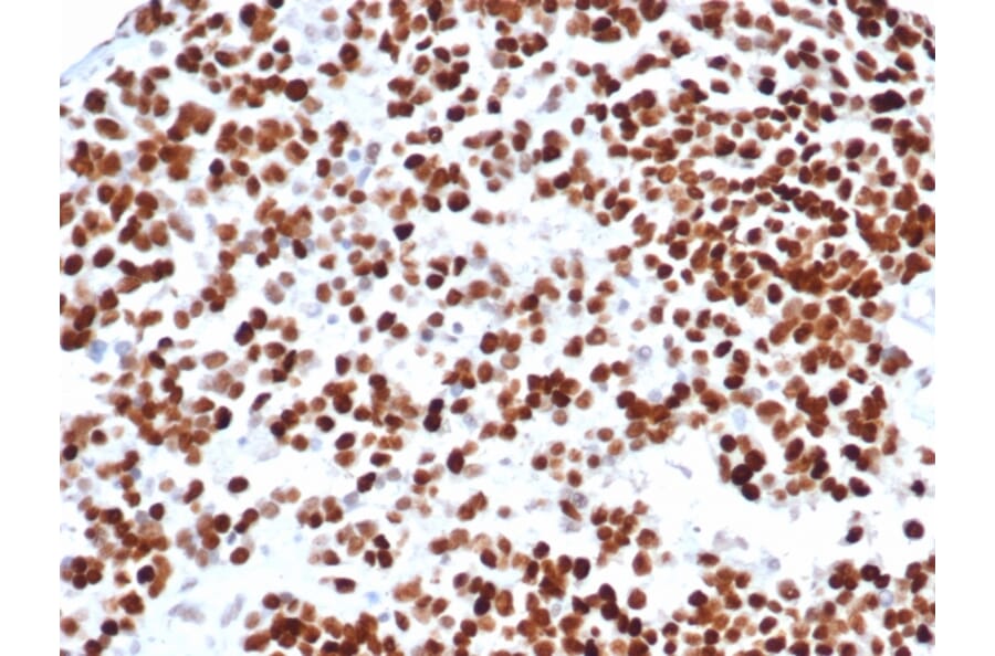 Immunohistochemistry - Anti-p53 Antibody [rTP53/6927] (A277926) - Antibodies.com
