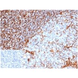 Immunohistochemistry - Anti-Vimentin Antibody [rVIM/6914] (A277927) - Antibodies.com