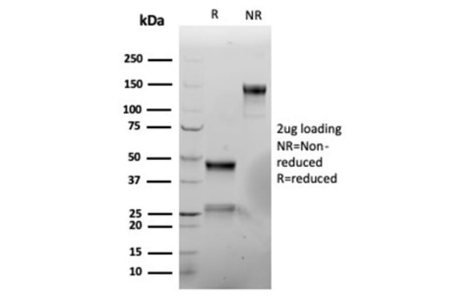 SDS-PAGE - Anti-Vimentin Antibody [rVIM/6914] (A277927) - Antibodies.com