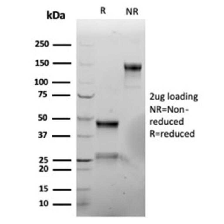 SDS-PAGE - Anti-Vimentin Antibody [rVIM/6914] (A277927) - Antibodies.com