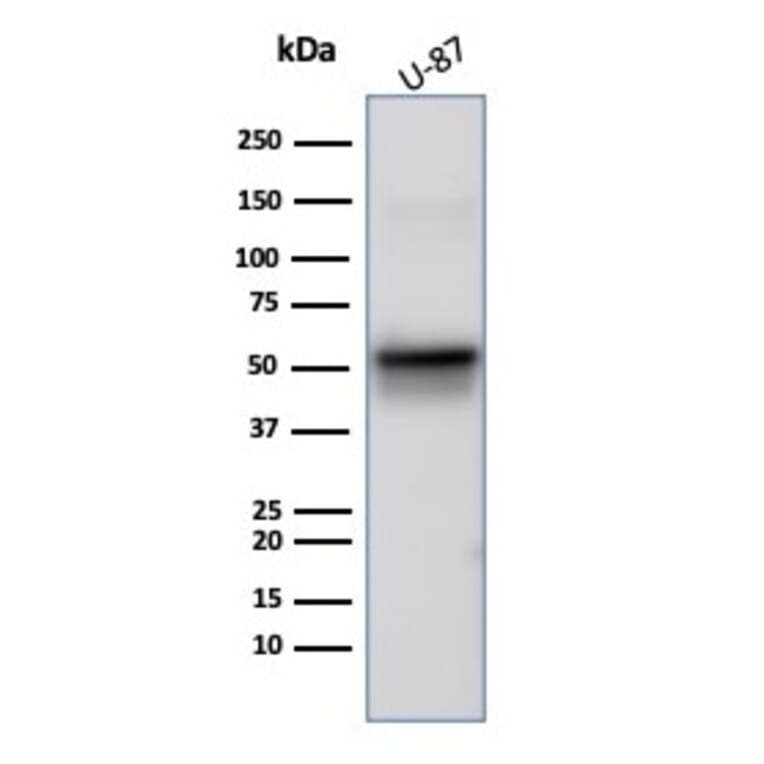 Western Blot - Anti-Vimentin Antibody [rVIM/6914] (A277927) - Antibodies.com