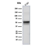 Western Blot - Anti-Vimentin Antibody [rVIM/6914] (A277927) - Antibodies.com