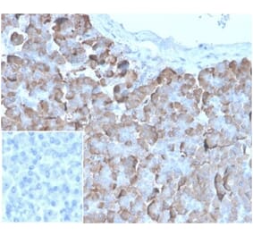 Immunohistochemistry - Anti-VLDL Receptor Antibody [rVLDLR/1337] (A277928) - Antibodies.com