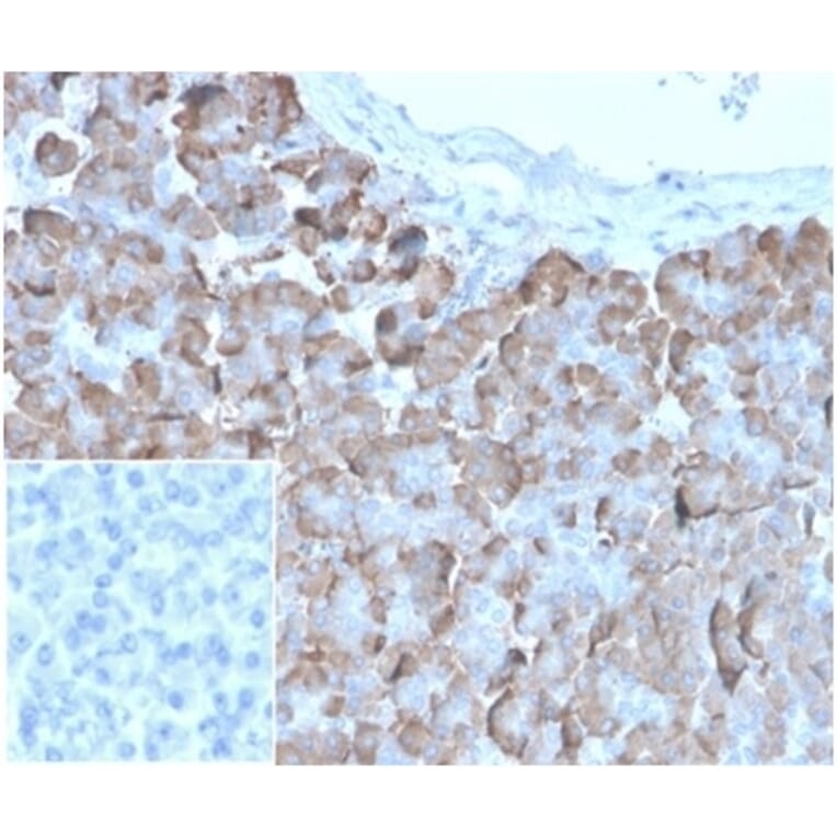 Immunohistochemistry - Anti-VLDL Receptor Antibody [rVLDLR/1337] (A277928) - Antibodies.com