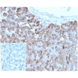 Immunohistochemistry - Anti-VLDL Receptor Antibody [rVLDLR/1337] (A277928) - Antibodies.com