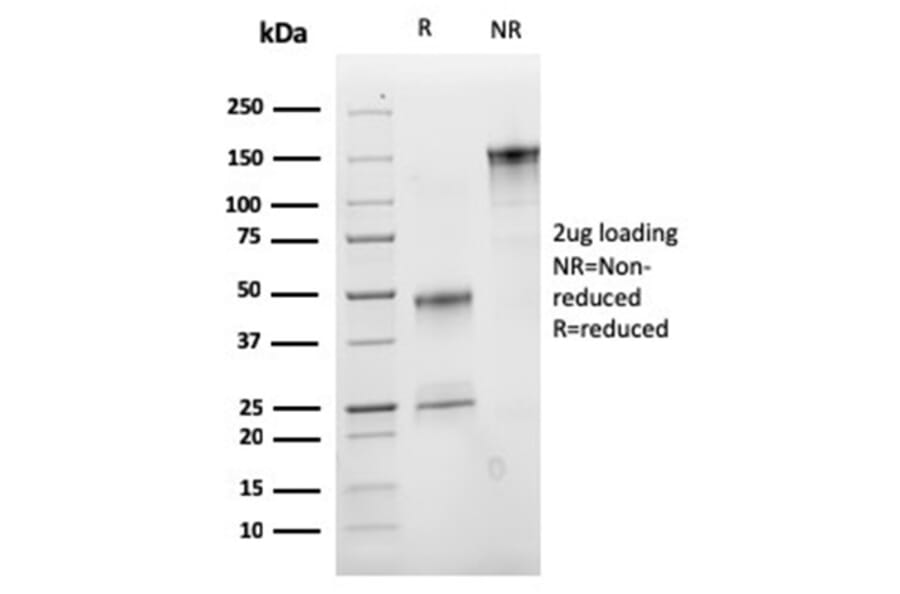 SDS-PAGE - Anti-VLDL Receptor Antibody [rVLDLR/1337] (A277928) - Antibodies.com