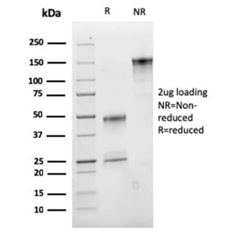 SDS-PAGE - Anti-VLDL Receptor Antibody [rVLDLR/1337] (A277928) - Antibodies.com