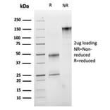 SDS-PAGE - Anti-VLDL Receptor Antibody [rVLDLR/1337] (A277928) - Antibodies.com