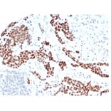 Immunohistochemistry - Anti-Wilms Tumor Protein Antibody [rWT1/6908] (A277929) - Antibodies.com