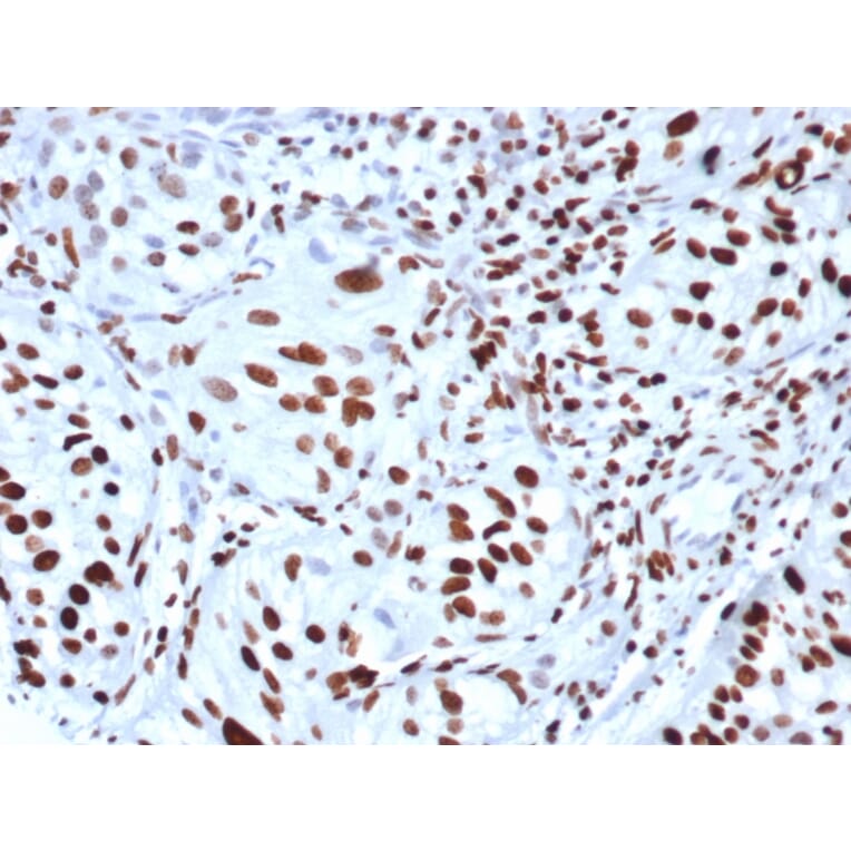 Immunohistochemistry - Anti-Histone H3 (phospho Ser10) Antibody [rPHH3/6824] (A277930) - Antibodies.com