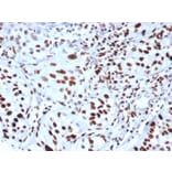 Immunohistochemistry - Anti-Histone H3 (phospho Ser10) Antibody [rPHH3/6824] (A277930) - Antibodies.com