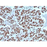 Immunohistochemistry - Anti-Cyclin E1 Antibody [rCCNE1/4936] (A277931) - Antibodies.com