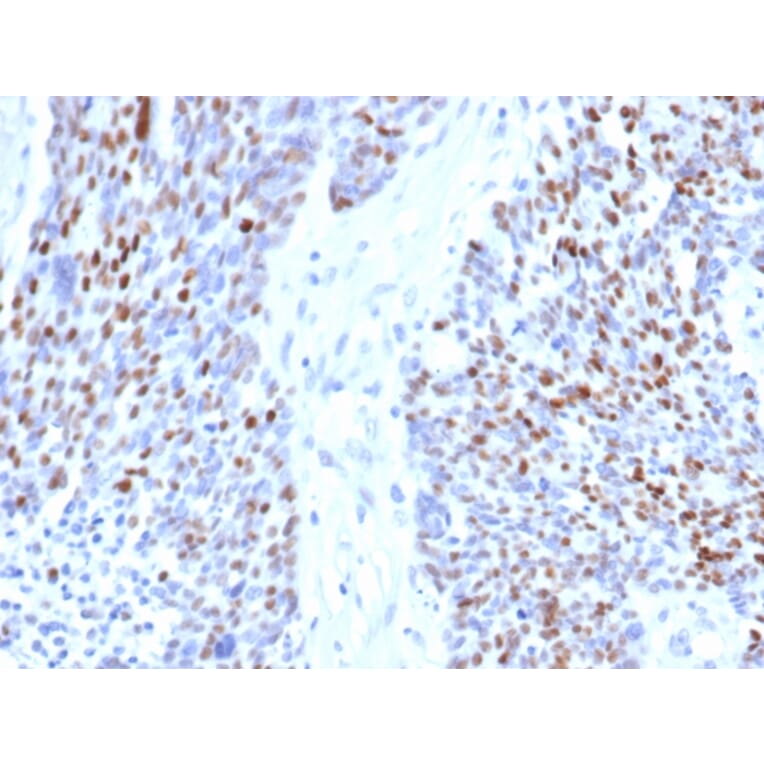 Immunohistochemistry - Anti-Cyclin E1 Antibody [rCCNE1/4936] (A277931) - Antibodies.com