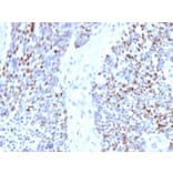 Immunohistochemistry - Anti-Cyclin E1 Antibody [rCCNE1/4936] (A277931) - Antibodies.com