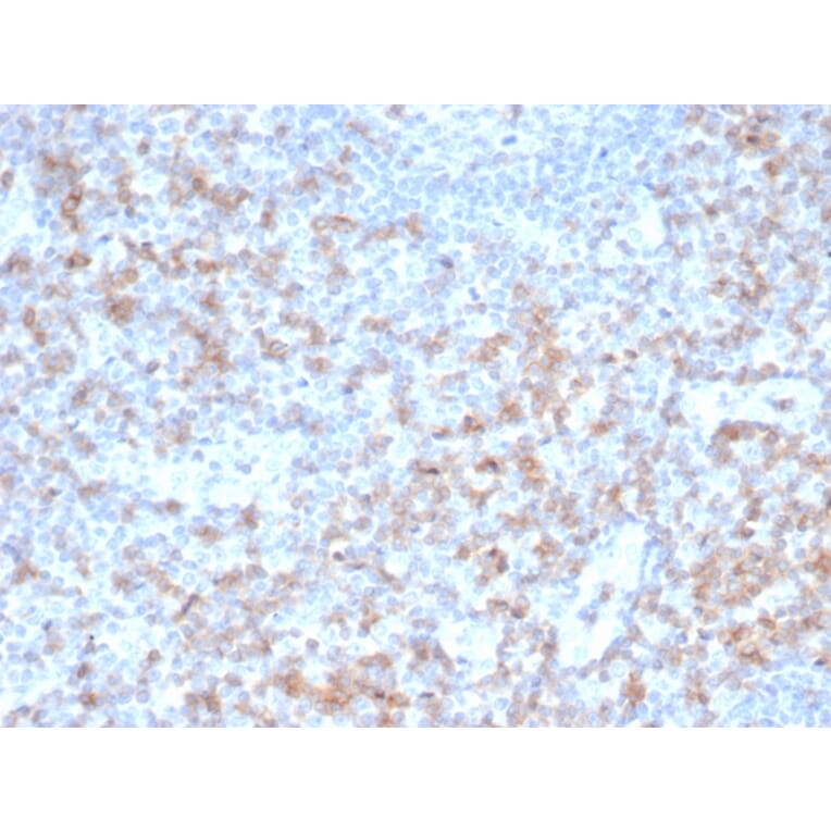 Immunohistochemistry - Anti-CD5 Antibody [rC5/6462] (A277932) - Antibodies.com