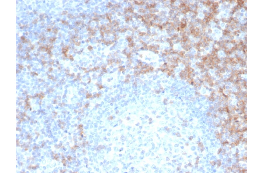 Immunohistochemistry - Anti-CD5 Antibody [rC5/6462] (A277932) - Antibodies.com