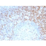 Immunohistochemistry - Anti-CD5 Antibody [rC5/6462] (A277932) - Antibodies.com