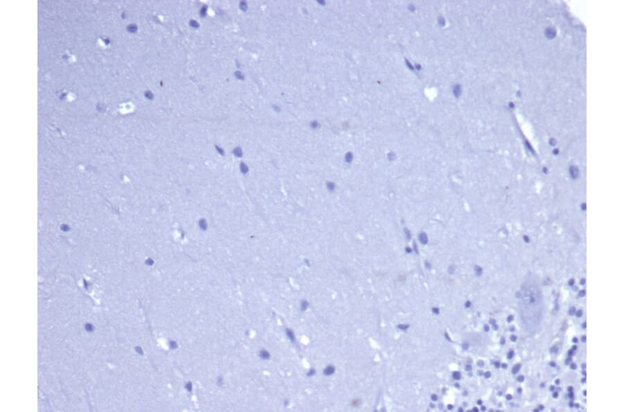 Immunohistochemistry - Anti-CD5 Antibody [rC5/6462] (A277932) - Antibodies.com