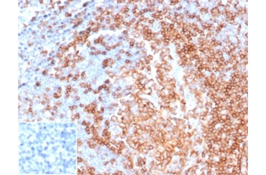 Immunohistochemistry - Anti-CD22 Antibody [rBLCAM/6749] (A277934) - Antibodies.com