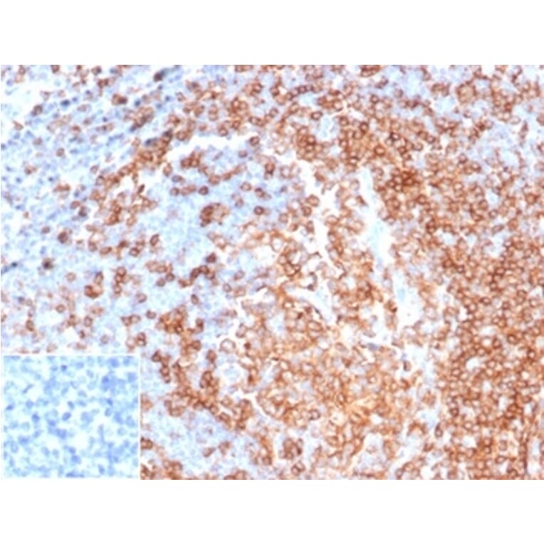 Immunohistochemistry - Anti-CD22 Antibody [rBLCAM/6749] (A277934) - Antibodies.com