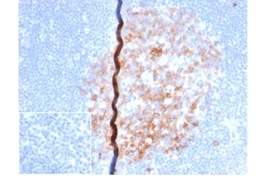 Immunohistochemistry - Anti-CD86 Antibody [rC86/6872] (A277935) - Antibodies.com