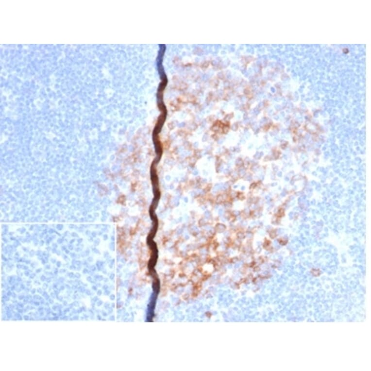 Immunohistochemistry - Anti-CD86 Antibody [rC86/6872] (A277935) - Antibodies.com