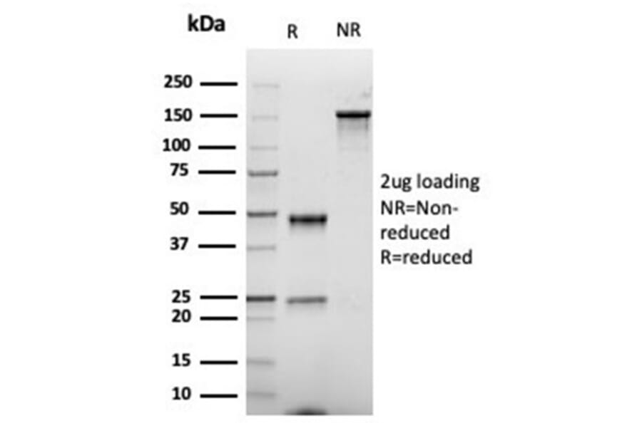 SDS-PAGE - Anti-CD86 Antibody [rC86/6872] (A277935) - Antibodies.com