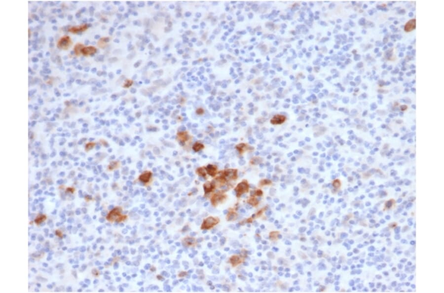 Immunohistochemistry - Anti-CD30 Antibody [rKi-1/6913] (A277936) - Antibodies.com
