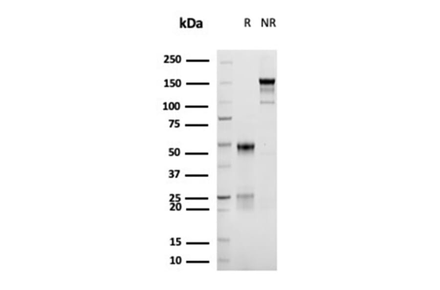 SDS-PAGE - Anti-CD30 Antibody [rKi-1/6913] (A277936) - Antibodies.com