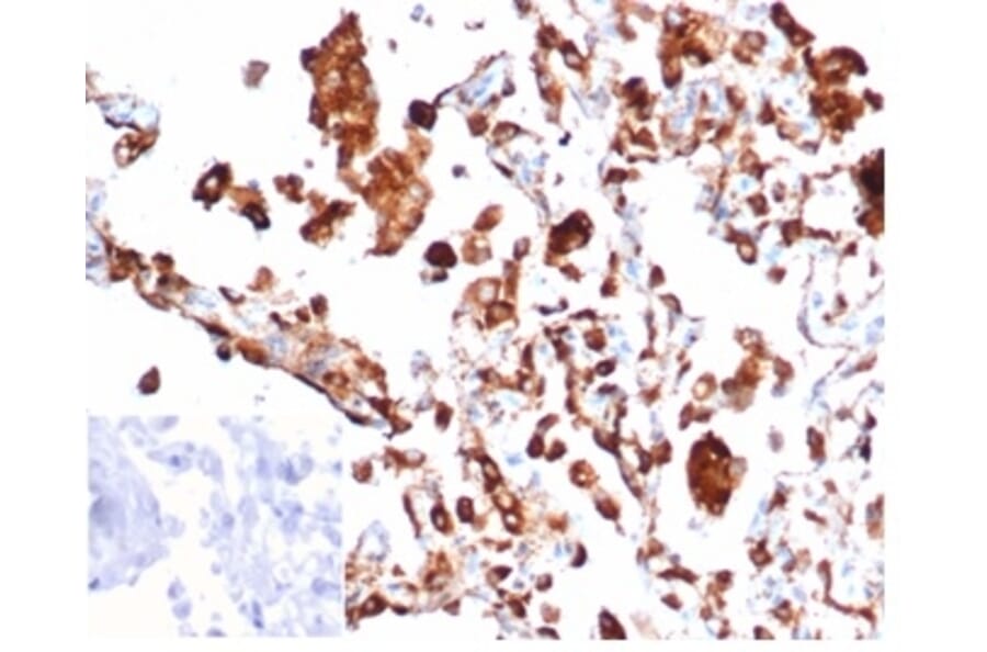 Immunohistochemistry - Anti-NAPSIN A Antibody [rNAPSA/6926] (A277937) - Antibodies.com