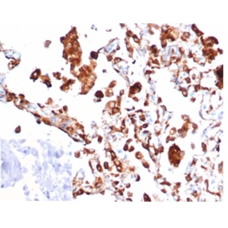 Immunohistochemistry - Anti-NAPSIN A Antibody [rNAPSA/6926] (A277937) - Antibodies.com