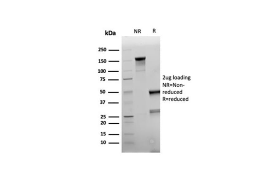 SDS-PAGE - Anti-NAPSIN A Antibody [rNAPSA/6926] (A277937) - Antibodies.com
