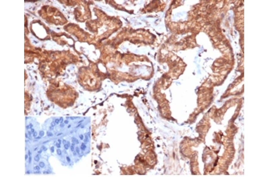 Immunohistochemistry - Anti-CD47 Antibody [rCD47/6365] (A277938) - Antibodies.com