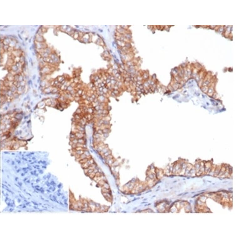 Immunohistochemistry - Anti-CD47 Antibody [rCD47/6589] (A277939) - Antibodies.com