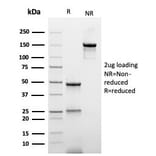SDS-PAGE - Anti-His Tag Antibody [r6HIS/6423] (A277941) - Antibodies.com