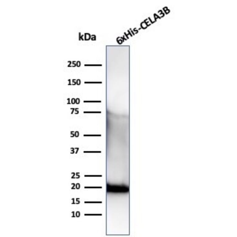 Western Blot - Anti-His Tag Antibody [r6HIS/6423] (A277941) - Antibodies.com