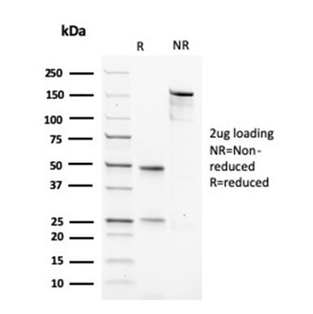 SDS-PAGE - Anti-Muscle Actin Antibody [rMSA/953] (A277943) - Antibodies.com