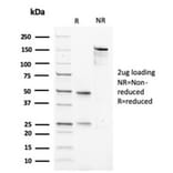 SDS-PAGE - Anti-Muscle Actin Antibody [rMSA/953] (A277943) - Antibodies.com