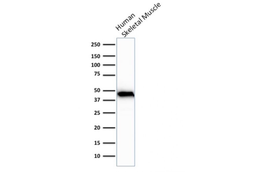 Western Blot - Anti-Muscle Actin Antibody [rMSA/953] (A277943) - Antibodies.com